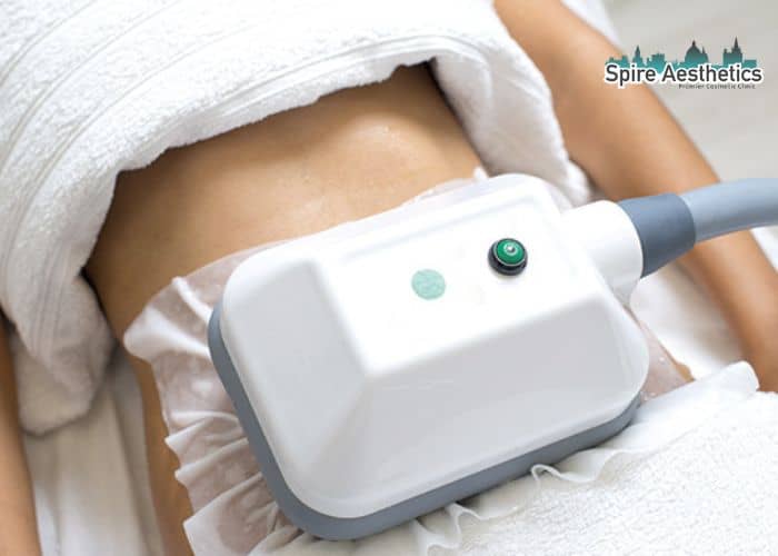 Shift Those Extra Pounds: How Fat Freezing Can Help You Slim Down Cardonald